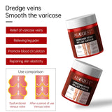 Varicose Vein Relief Cream