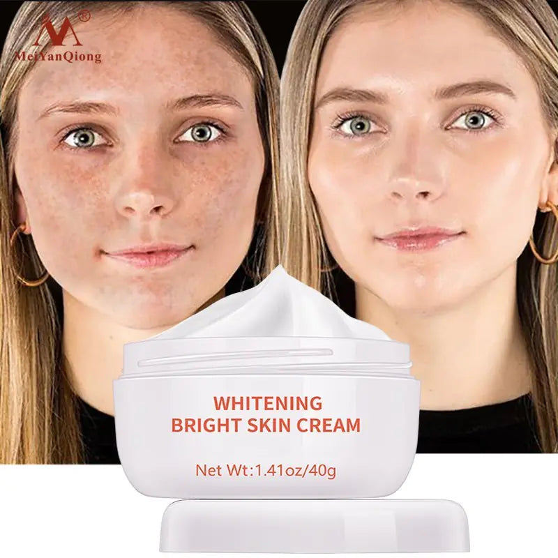 Powerful Whitening Freckle Remover Cream