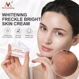 Powerful Whitening Freckle Remover Cream