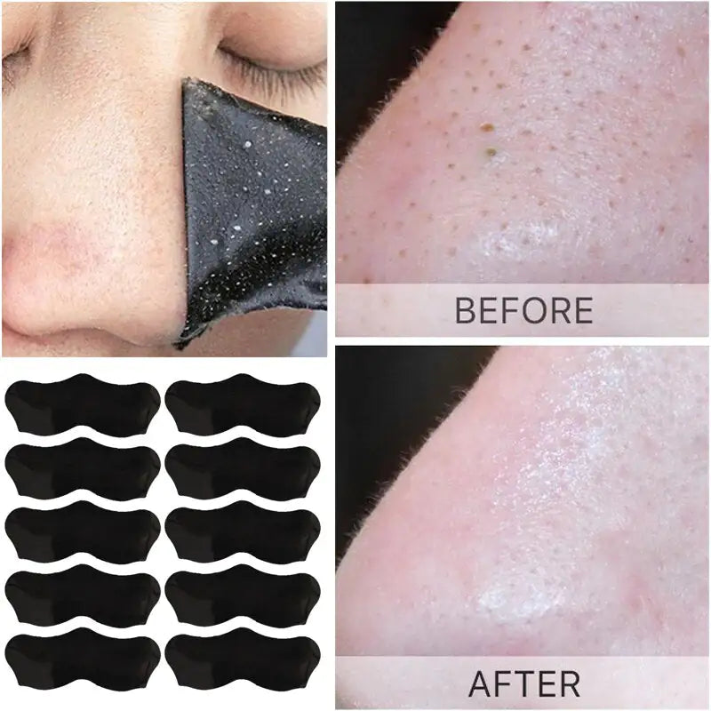 Unisex Blackhead Nasal Strips