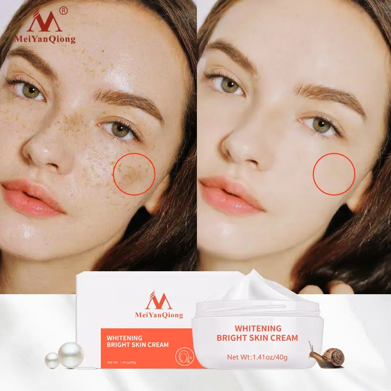 Powerful Whitening Freckle Remover Cream