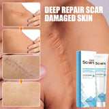 New Herbal Scar Remover Cream