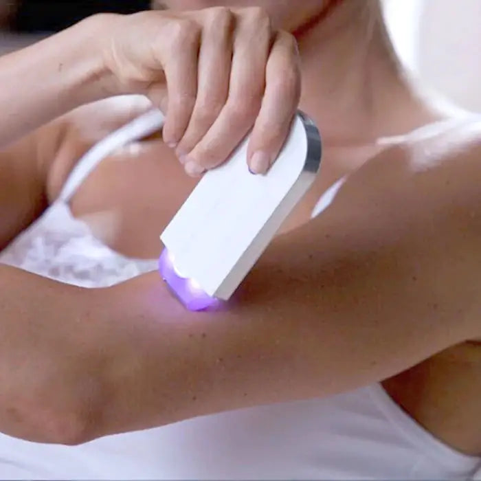 Laser Epilator