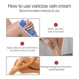 Varicose Vein Relief Cream