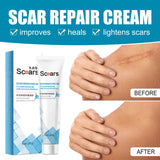 New Herbal Scar Remover Cream